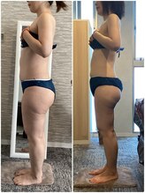 ハレアンド(Hare&)/40代全身痩身15回目