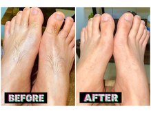 メンズスリーナインサロン(Men's ThreeNines Salon)/脚の甲・指