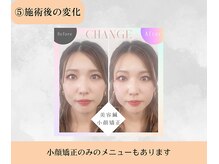 たけだ整体院 鍼灸院/施術後の変化