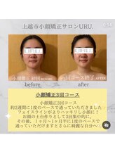 ウル(URU.)/継続して受けて頂くことで効果大