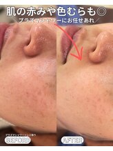 ベルファーム(Belle Femme)/