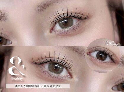 グロウ(glow)の写真