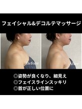 シュ シュ(chou chou)/フェイシャルデコルテマッサージ