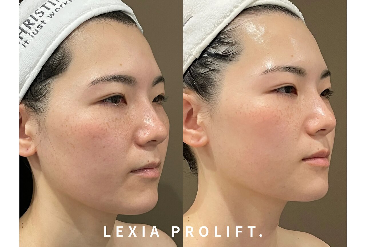 茅ヶ崎駅で美白エステが人気のエステサロン｜ホットペッパービューティー
