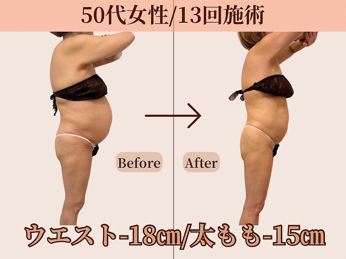 ベルホワイト(Belle White)｜ホットペッパービューティー