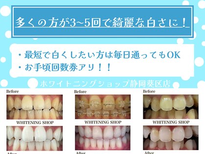 ホワイトニングショップ 葵区静岡駅店の写真