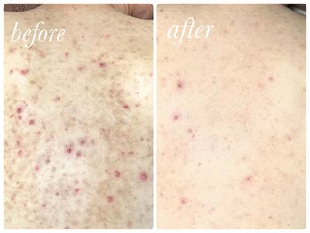 チップ(chip)/ここまで変わる