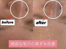 イイプラス(ii+)