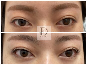 ビューティーベリッシモ(Beauty Bellissimo)/《ダブルアイリフト》