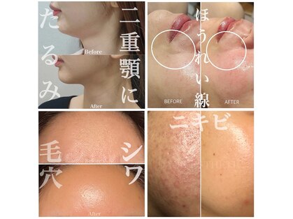 多穏スキンケア(skin care)の写真