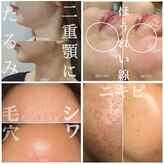 多穏スキンケア(skin care)