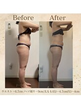 エソール(essor)/WINBACK痩身90分