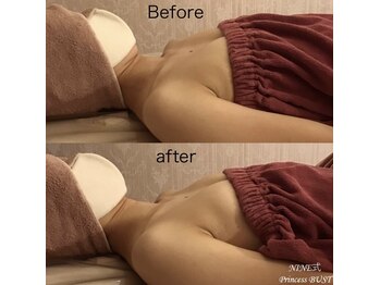 ベッピン(Beppin)/3回モニター様/ブライダル