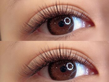 アリー(Ally)/デザインキープラッシュ