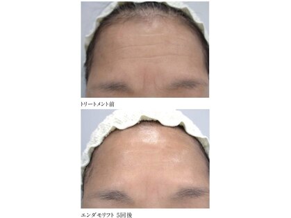 ミロク 伏見桃山店(miroku)の写真