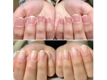 あなたのお悩み、自爪育成専門サロンにお任せください！