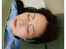 一二三鍼灸マッサージ治療院/【顎関節の不調】一例