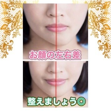 電気鍼 美容機器 Anon（アノン） アノン 松山(Anon)｜ホットペッパービューティー