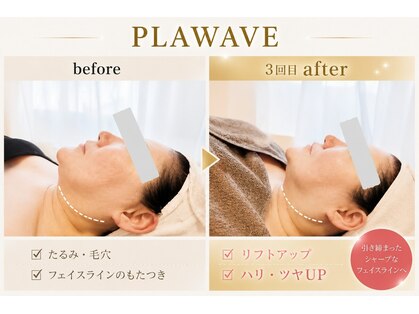 ソルイルナ 麻布十番店(sol y luna)の写真