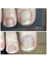 エヌスタイル(N-STYLE)/