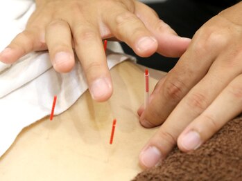 フォーユー 門真院(for you)/慢性・急性ともに効く！鍼灸施術