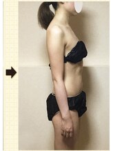 ノットノット 自由が丘(Not Knot)/２.ブライダル シンデレラ10回後