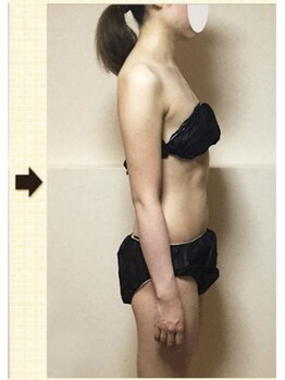 ノットノット 自由が丘(Not Knot)/２.ブライダル シンデレラ10回後