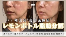 アルス(ars)