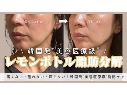 アルス(ars)の写真