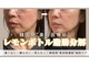 アルス(ars)の写真