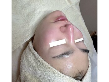 プリエ(Prier)/肌質改善・ニキビケア