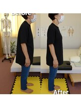 からだ回復センター 八幡西/【姿勢改善】丸い背中がピーン