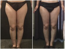 ウェリナ平和堂長久手院/小顔矯正/骨盤矯正/美脚サロン