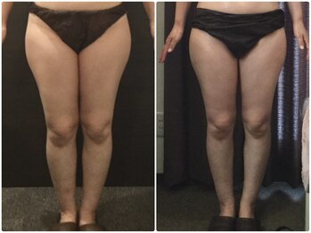 ウェリナ平和堂長久手院/小顔矯正/骨盤矯正/美脚サロン