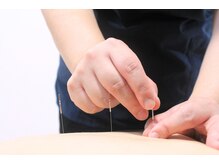 代官山アサ接骨院 鍼灸院(代官山 Asa 接骨院 鍼灸院)/鍼とお灸で腰痛解消へ