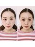 【小顔になりたい!!体のお悩みにも◎】魔法の小顔矯正+骨盤矯正