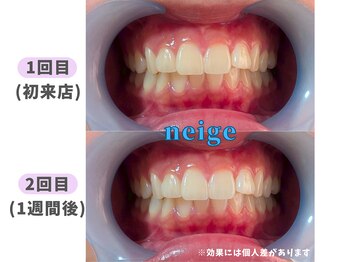 ネージュ(neige)/20代前半/女性/お茶1日4杯