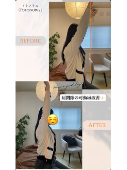 トトノリス(Totonoris)/ビフォーアフター