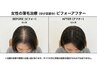1ヶ月新毛保証コース(スコープ診断込み) 女性限定クーポン！