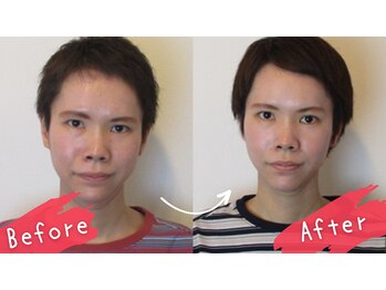 小顔 美容整体サロン ハチ( HACHI)の写真/憧れの小顔とリフトアップを同時に◎根本改善を目指す本格施術で、歪みが整い戻りにくい感動体験を♪