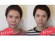 小顔 美容整体サロン ハチ( HACHI)の写真/憧れの小顔とリフトアップを同時に◎根本改善を目指す本格施術で、歪みが整い戻りにくい感動体験を♪