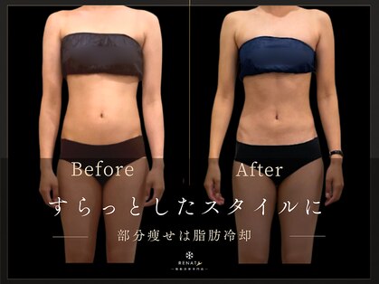 レナータ 横浜店(RENATA)の写真