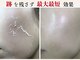 ビースキン 広島(BE:SKIN)の写真