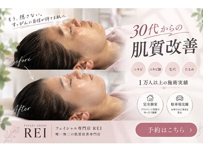 レイ(REI)の写真
