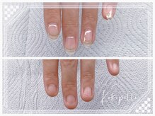 ココペリ(Nail Salon＆School kokopelli)/深爪が2ヶ月で美爪に！！