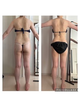 ヘルス アンド ハビッツ(Health and HABITS)/ドレスに合わせて背中も美しく☆