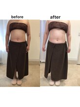 ジョワイユ(Joyeux)/腸の位置でお腹は変わる