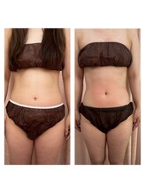 フェデネージュ(fee des neige)/ここまで変化【ダイエット】