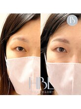 トゥルヌソル 宇都宮(tournesol)/ハリウッドブロウリフト