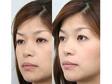 からだケア なのはなの雰囲気(人気の小顔矯正【全てのコースの方に施術します】追加料金なし♪)